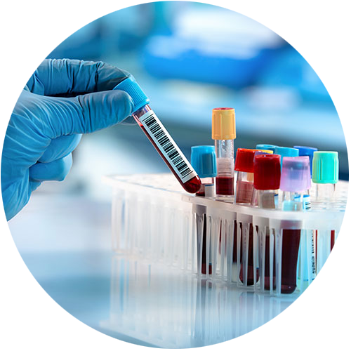Lab-vials